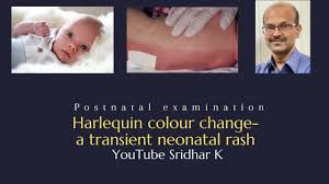 Image result for Harlequin Color Change