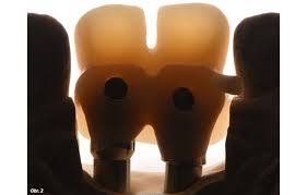 Image result for ochrana chrupu