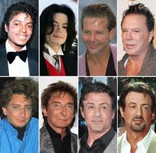 Male Celebrity Plastic Surgery Transformations Before And After Photos Celebrity Plastic Surgery Celebrity Surgery Botched Plastic Surgery