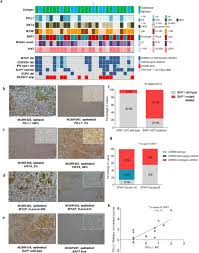 Patients with sarcomatoid mpm tend to have the worst outcomes with median survival ranging. Integrated Genomics Identify Novel Immunotherapy Targets For Malignant Mesothelioma Medrxiv