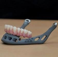 An 83 Year Old Woman Belgian Woman Has Become The First Ever Person To Receive A Transplant Jawbone Tailor Made For Her Face 3 Boyutlu Yazici Yazici Teknoloji