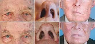 A Contemporary Approach to Facial Reanimation