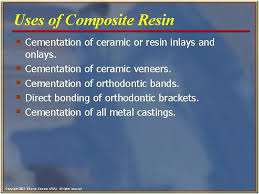We did not find results for: Chapter 45 Dental Cements Copyright 2003 Elsevier Science