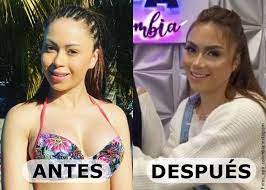 Al ritmo de 'el makinon' de karol g, epa colombia sorprendió a sus seguidores con un video en su cuenta de instagram en el que presentó su nueva lujosa adquisición: Epa Colombia Tras Cirugia De Nariz Como Quedo Vibra