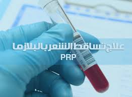 حقن البلازما للشعر Prp الغنية بالصفيحات الدموية Infinity Hair