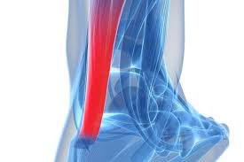 Tak hanya dirasakan oleh tangan, kaki mati rasa pun bisa terjadi. Kaki Pergelangan Kaki