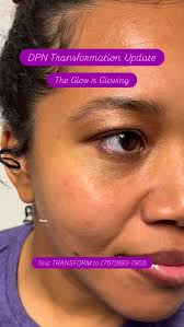 She trusted the process… and the results showed up again at her follow-up  appointment., Her skin is smoother. Her confidence is higher., This is why  I do what I do. 💜, Text TRANSFORM to (757)993-7805 ...