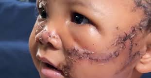 We thought she was dead:' Las Vegas toddler recovering after dog attack.  The parents tell FOX5 last week they were staying at Hendrickson's  brother's house who owns a a XL American bully.