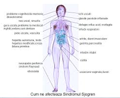 Pot sa beau si 4 l de apa ca nu imi trece, tot raman cu senzatia de gat uscat. Simptome Sindromul Sjogren Sjogren