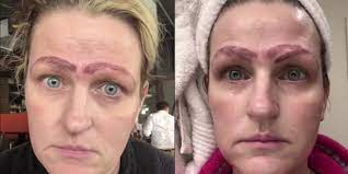 Missouri Woman S Botched Microblading Procedure Goes Viral Allure When you've tried every pencil, powder, pigment, gel, and stencil at the makeup counter and your brows are still sparse, there's microblading, a more permanent fix for thin brows that.