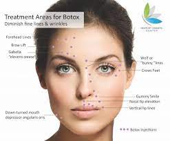 These lines appear after years of repeatedly furrowing the brows. Botox Injection Sites Face Diagram Botox Injection Sites Botox Injections Botox