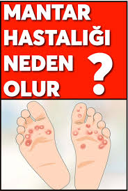 Mantar Hastaligi Neden Olur