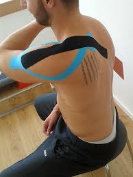 Kinesiologisches Taping My Medibook