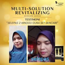 Ini adalah feedback atau testimoni #setskincaretrialpacknurraysa. Set 5 In 1 Multi Solution Revitalizing Skincare Series Tanpa Toner Nurraysa Beauty Produk Wanita Muslimah