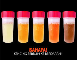 Namun, pelbagai keadaan perubatan juga boleh memberi kesan ini. Luxebyte Health World Posts Facebook