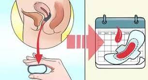 How to stop your period on the first day? How To End Your Period 11 Steps With Pictures Wikihow