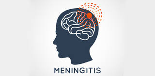 Healthcare wouldn't be what it is today if we didn't have the women and men who he. The Meningitis Quiz Trivia Questions Proprofs Quiz