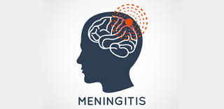 Buzzfeed staff can you beat your friends at this quiz? The Meningitis Quiz Trivia Questions Proprofs Quiz