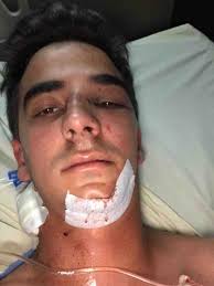 Fundraiser by Pedro Rodriguez : Help Jhonny's Surgery