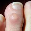 While covid toes and rashes have been associated with the coronavirus more than other viral infections, dr. Https Encrypted Tbn0 Gstatic Com Images Q Tbn And9gctp1b6pmuzpsrmsrskuz4yjhkvqxd2c6znw5syytbywk6zlcajl Usqp Cau