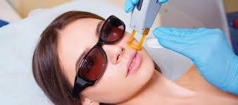 Laser hair removal is a process where light (aka the laser beams) is directed onto your skin in little pulses, targeting and heating up the hair. All You Need To Know About Laser Facial Hair Removal Safar Medical