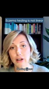 If you're dealing with eczema, you know itch can be one of the most  miserable parts. It's constant. It disrupts your sleep. It makes you  irritable, anxious, and exhausted. Here's the kicker -