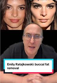 Emily Natural Minjerobweight Loss
