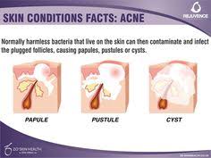 Cells enter the sac and get packed together and pushed out resulting in hair. 8 Sebaceous Glands Ideas Sebaceous Gland Glands Sweat Gland
