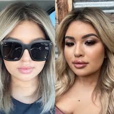 THE BEST 10 Audiologist near MORAGA, CA 94556