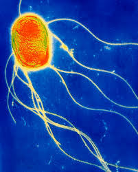 A number of its serovars are serious human pathogens. Salmonella Enteritidis Bacterium Photograph By A B Dowsett