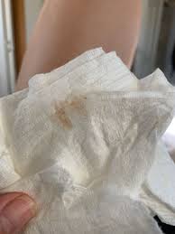 Other factors besides pregnancy can influence what the cervical fluid looks like. Bloody Discharge 6 Weeks Pregnant