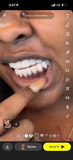 Getting second set of braces at 34 years old