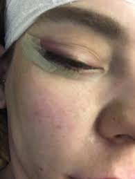 uzgun ilk ayak sesleri cilt bakimi fiyatlari kadinlar kulubu swedishschoolofcharlotte com