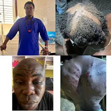 Remembering Hon. Zakawanu Garuba: A Political Gladiator By Ikharo Seluman  Selvox Media Networks In the annals of Nigerian politics, Hon. Zakawanu  Garuba etched his name as a figure of unflinching resolve, charismatic