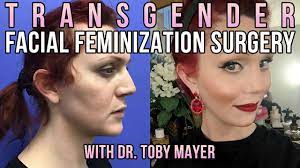 Transgender Facial Feminization Surgery Before And After - Dr. Toby Mayer -  YouTube