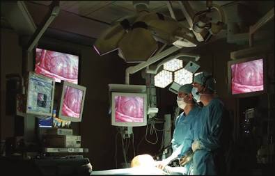Laparoscopic surgery utilizes high-definition monitors, AI generated
