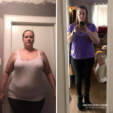 Pin On Weight Loss Surgery Testimonials