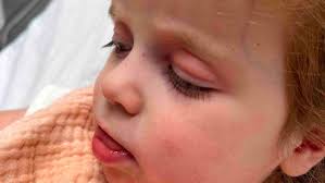 Fundraiser for Michelle Radice by Elyse Lottier : Help for Sweet Gianna  "Dolly" & the Radice Family