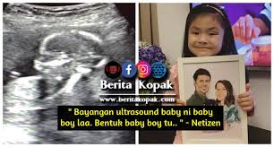Anda boleh memuat turun gambar bayi png percuma dengan latar belakang telus dari koleksi terbesar di pngtree. Bayangan Ultrasound Baby Ni Baby Boy Laa Bentuk Baby Boy Tu Netizen Berita Kopak Cc
