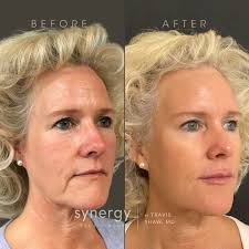 Whitney Lange, MSN, NP, CANS (@injections.by.whitney) · Richmond, VA