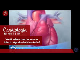 O infarto agudo do miocárdio (iam), também conhecido como infarto ou ataque cardíaco, corresponde à interrupção da passagem de sangue para o coração, o que provoca a morte das células cardíacas e causa sintomas como dor no peito que pode irradiar para o braço. Voce Sabe Como Ocorre O Infarto Agudo Do Miocardio Youtube