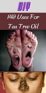 Tea Tree Oil Is More Useful Than You Think Here Are 40 Reasons You Need It At Home In 2021 Tea Tree Oil Tree Oil Pink Donuts