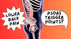 Image result for Psoas Sign