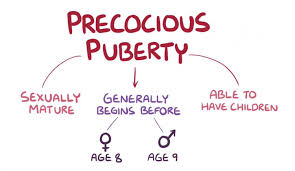 Image result for Precocious Puberty