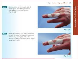 How To Tape Injured Finger Kinesiology Taping Finger Sports Therapy