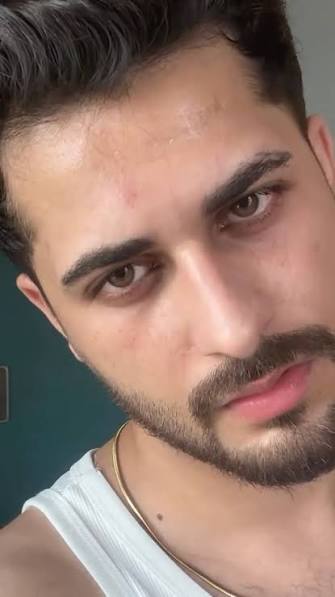 Bilal