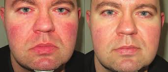 Clinical Casebook M22™ Treatments