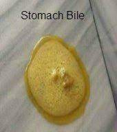 Maybe you would like to learn more about one of these? Shih Tzu Vomiting Yellow Bile Online Shopping