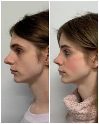 Mardirossian Facial...