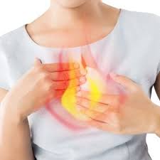 Image result for Gastrodia rwandensis